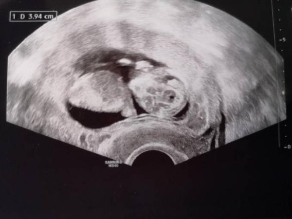Bild zu Jetzt offiziell nochmal eine November-Mama - Forum für November - Mamis