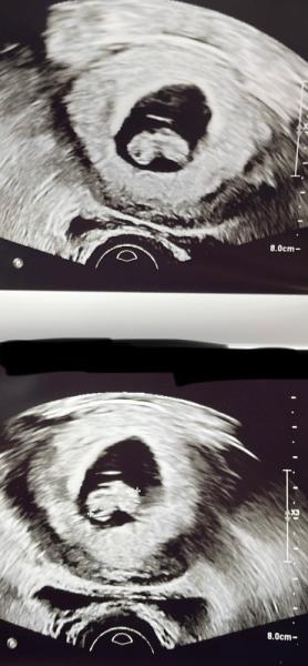 Bild zu Ramzi - Forum für November - Mamis