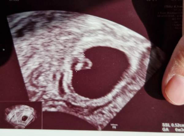 Bild zu Ramzi Methode - Forum für November - Mamis