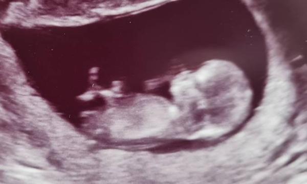 Bild zu Nub Theorie 12. SSW - Bitte Hilfe, Mädchen oder Bub? - Forum für November - Mamis