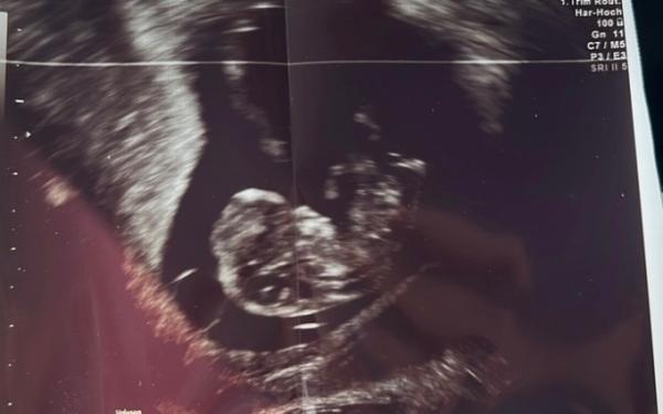 Bild zu Geschlecht - Forum für November - Mamis