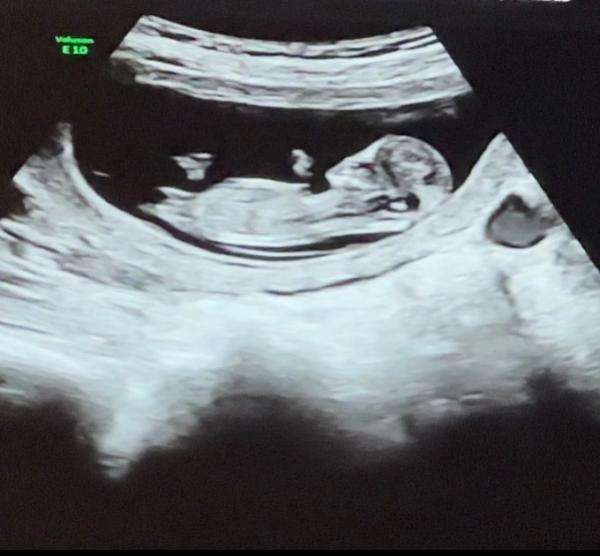 Bild zu Geschlecht? - Forum für November - Mamis