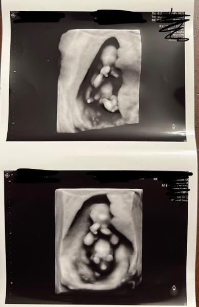 Bild zu Geschlechter raten *neugierig* - Forum für November - Mamis