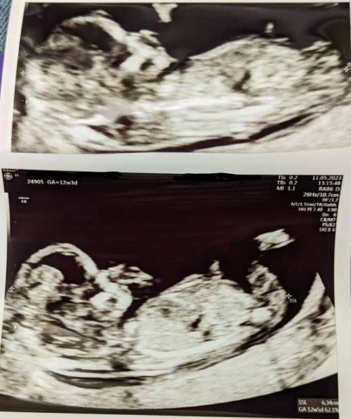 Bild zu Geschlechterraten - Forum für November - Mamis