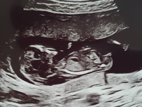Bild zu Combined test Ergebnis - Forum für November - Mamis