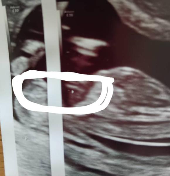 Bild zu Ich kann das Outing kaum noch erwarten - Forum für November - Mamis