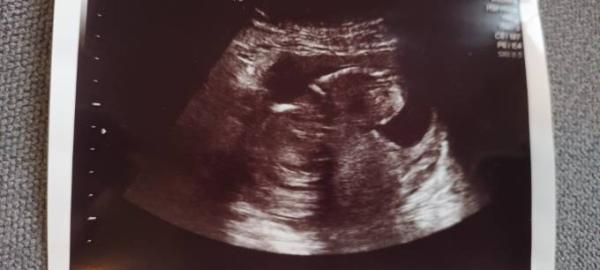 Bild zu Kann da jemand was erkennen? - Forum für November - Mamis