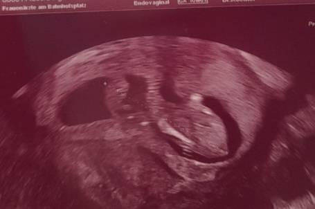 Bild zu Ich habe es "geschafft" - Forum für November - Mamis