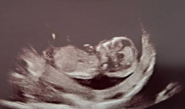Bild zu Was könnte es sein? - Forum für November - Mamis