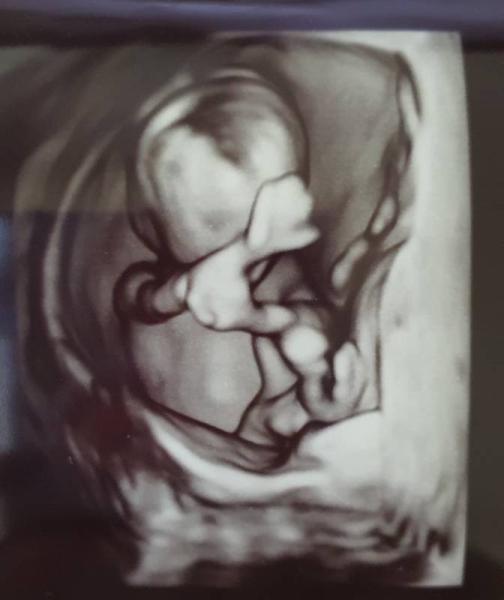 Bild zu Ultraschall Ersttrimesterscreening - Forum für November - Mamis