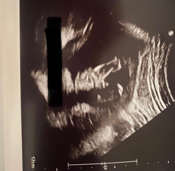 Bild zu Geschlecht / US Bild - Forum für November - Mamis