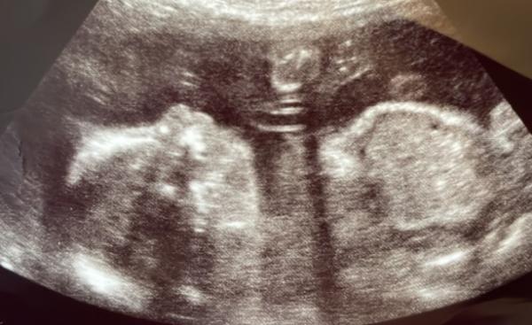 Bild zu Immer noch keine Gewissheit…. - Forum für November - Mamis