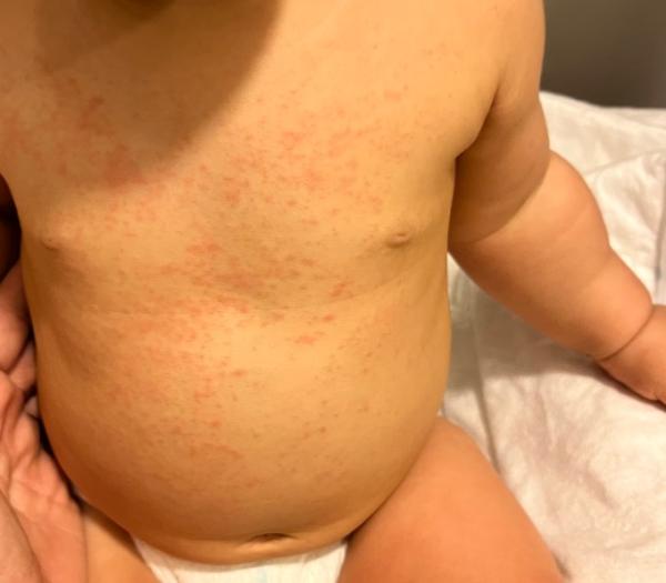 Bild zu Habt ihr sowas schon mal gesehen? - Forum für November - Mamis