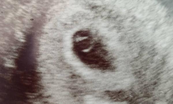 Bild zu Zurück vom FA❤️ - Forum für November - Mamis