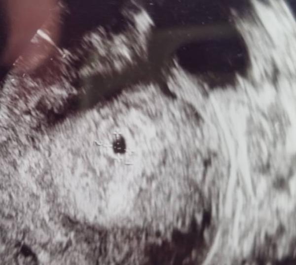 Bild zu Daumen drücken bitte - Forum für November - Mamis