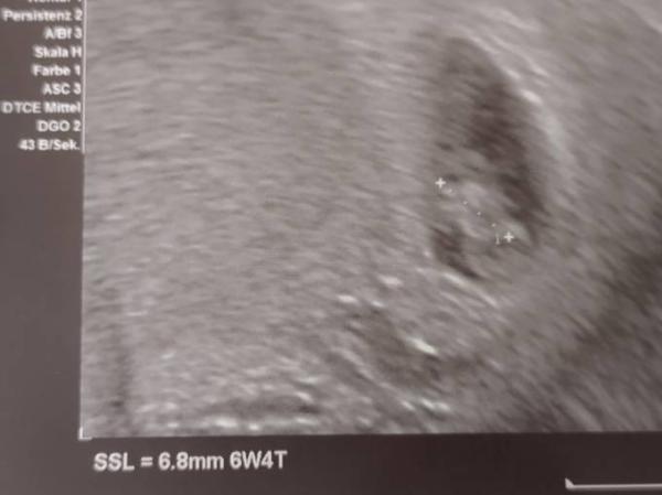 Bild zu Gestern 1. Termin bei FA mit Ultraschall 🥰 - Forum für November - Mamis