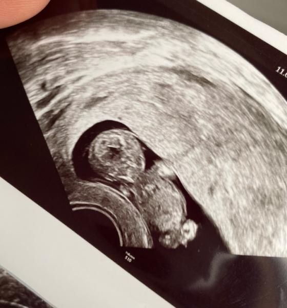 Bild zu Geschlecht raten 😋 - Forum für November - Mamis