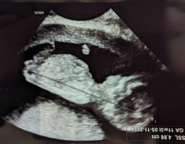 Bild zu Nub Theorie - Forum für November - Mamis