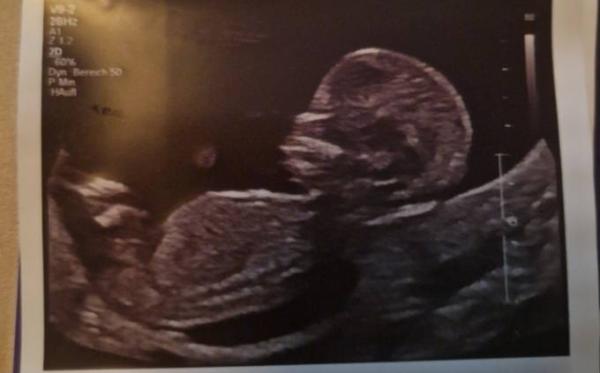 Bild zu Ultraschall Geschlrcht Theorie? :) - Forum für November - Mamis