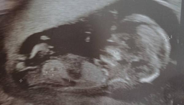 Bild zu 3 termin super - Forum für November - Mamis