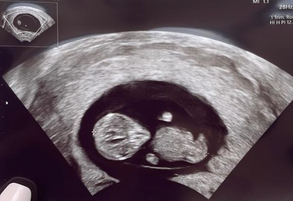 Bild zu Geschlechter raten :) - Forum für November - Mamis