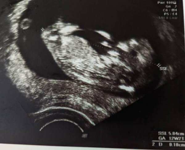 Bild zu November Baby- wer noch? 😊 - Forum für November - Mamis