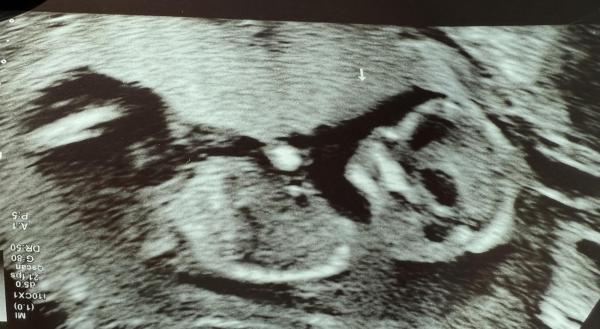 Bild zu Update - Screening - Forum für November - Mamis