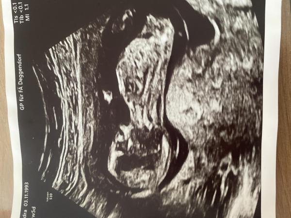 Bild zu Mädchen oder Junge - Nub-Theorie - Forum für November - Mamis