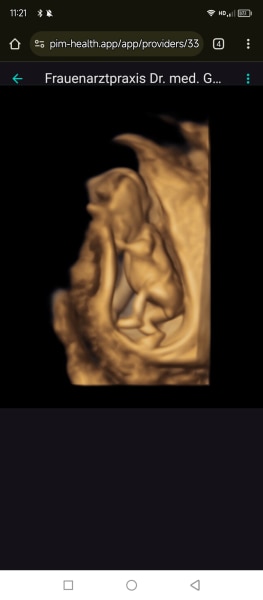 Bild zu NUB Theorie? 🩷💙❓ - Forum für November - Mamis