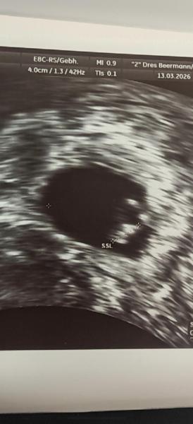 Bild zu Erster Ultraschall 6+1 - Forum für November - Mamis