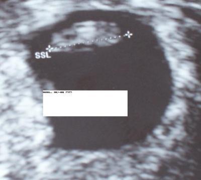 Bild zu US- Bild vom 16.04 und 30.04.2010 - Forum für Dezember - Mamis