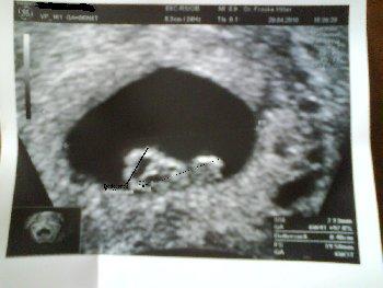 Bild zu Zeigt her eure Babys :) - Forum für Dezember - Mamis