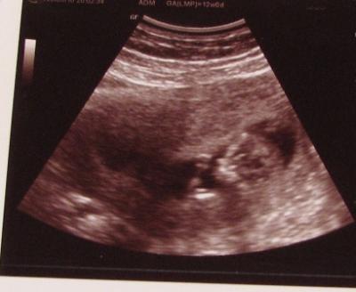 Bild zu Hier das versprochene... - Forum für Dezember - Mamis