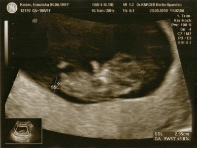 Bild zu Werd auch mal endlich einen Bericht hinterlassen ;D (lang) - Forum für Dezember - Mamis