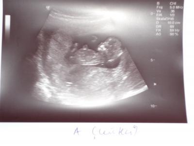 Bild zu Meine Zwillingsfotos :-) - Forum für Dezember - Mamis