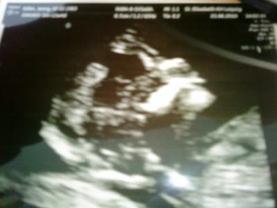 Bild zu 2 bilder - Forum für Dezember - Mamis