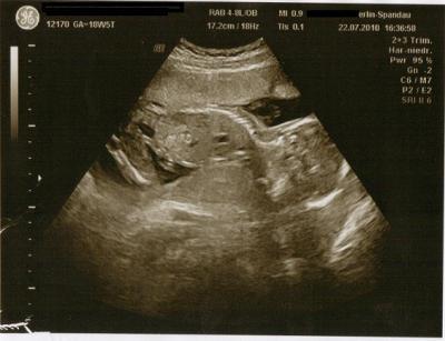 Bild zu Melde mich dann mal auch wieder. - Forum für Dezember - Mamis