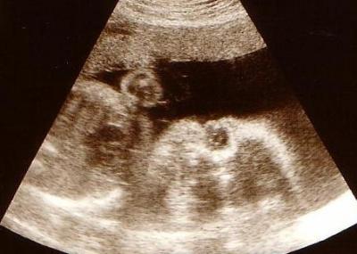 Bild zu Hallo - Forum für Dezember - Mamis