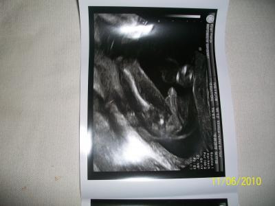 Bild zu Heute FD Ultraschall - Forum für Dezember - Mamis