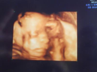 Bild zu Bin zurück von der FD :D - Forum für Dezember - Mamis