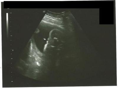 Bild zu Mein Mann war echt den Tränen nahe - Forum für Dezember - Mamis