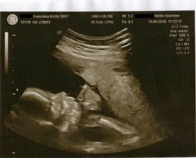 Bild zu Gestern FD + Frage - Forum für Dezember - Mamis