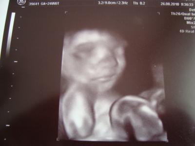 Bild zu 3d bild von mein baby.... - Forum für Dezember - Mamis