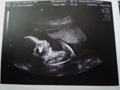 Bild zu Zurück von der VU mit Bildchen - Forum für Dezember - Mamis