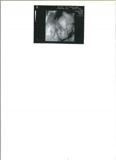 Bild zu Babyfoto - Forum für Dezember - Mamis