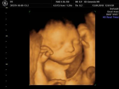 Bild zu Baby-TV - super schön - Forum für Dezember - Mamis