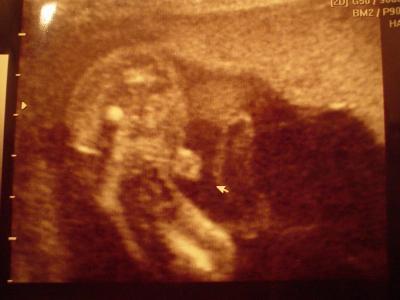 Bild zu Outingbild aus 22.woche,was denkt ihr? - Forum für Dezember - Mamis