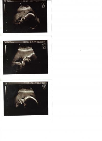 Bild zu Die versprochenen Bilder von Gestern :-) - Forum für Dezember - Mamis