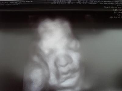 Bild zu Die US Bilder zu der gestrigen 4D Sono - Forum für Dezember - Mamis