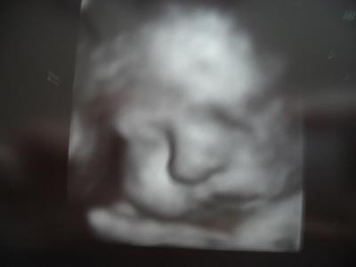 Bild zu VU + US Bild :o) - Forum für Dezember - Mamis